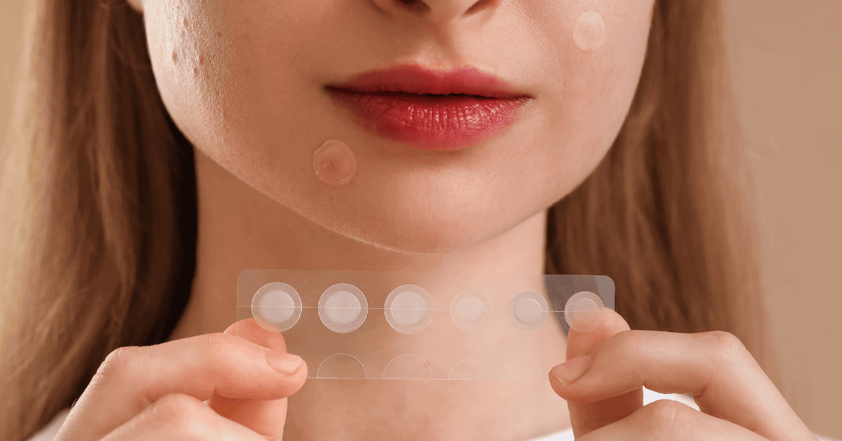acne-patch-healing-mechanism