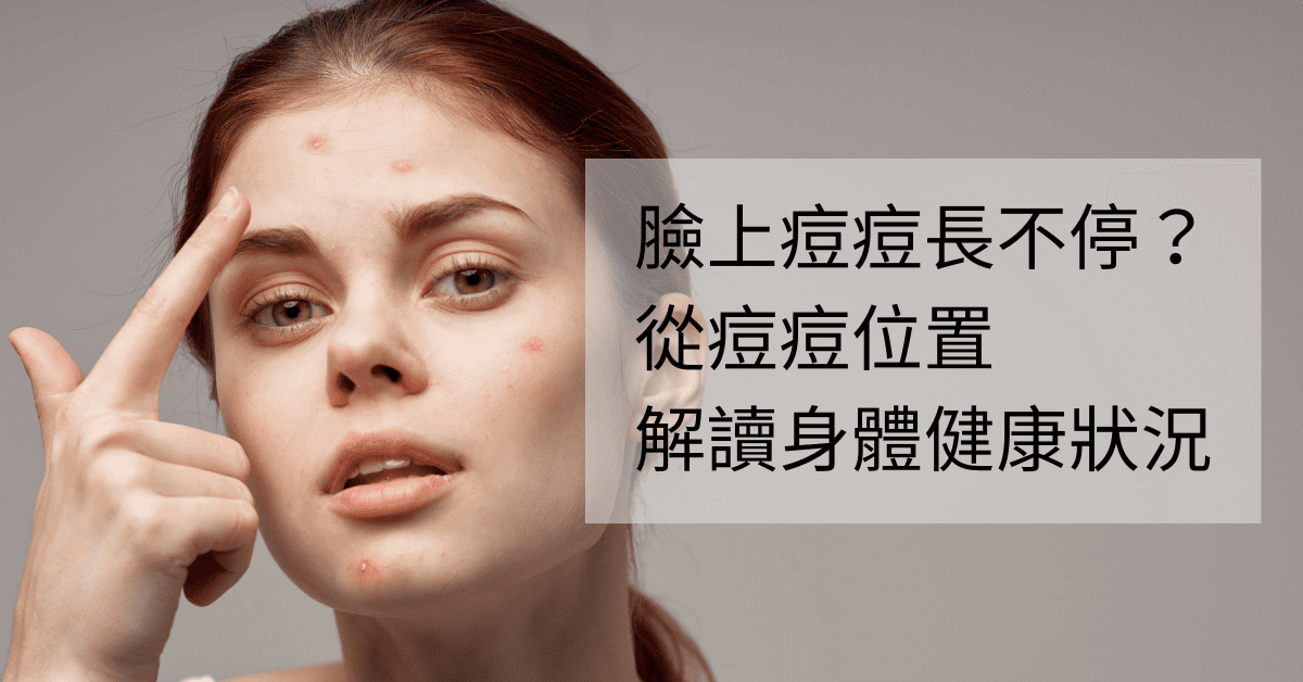 臉上痘痘長不停,從痘痘位子判斷身體健康狀況