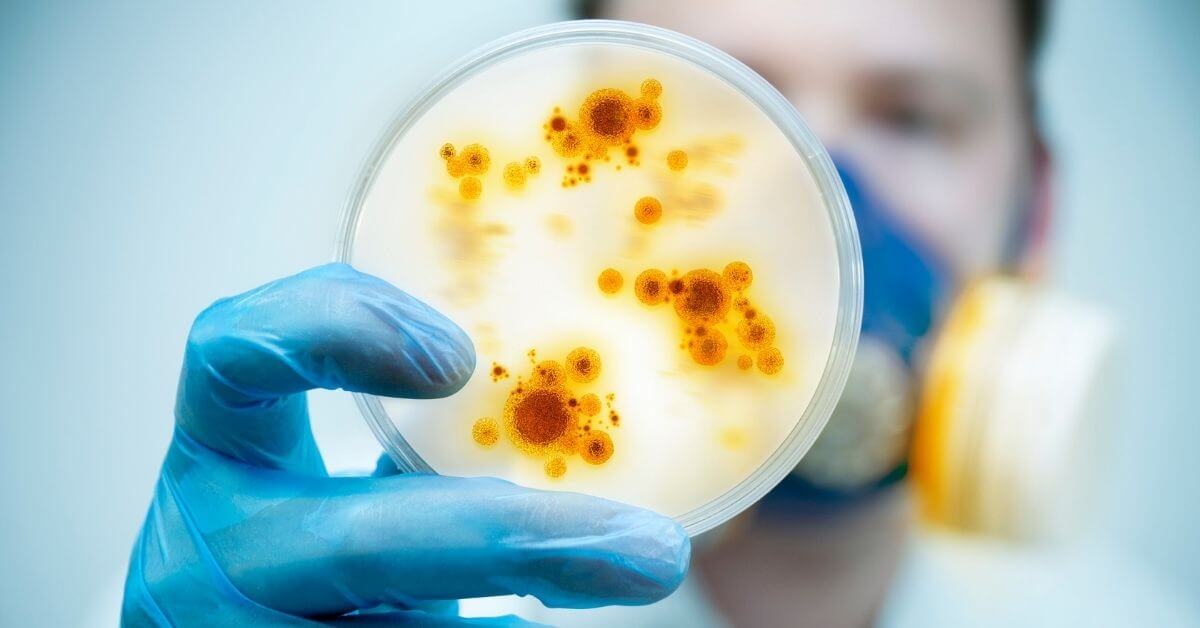 surgical site infections