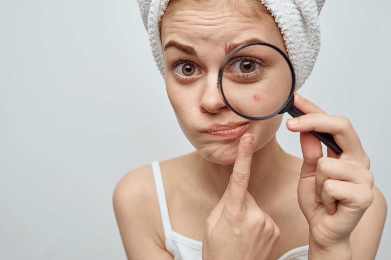 acne-patch-and-hydrocolloid-dressing-which-one-should-i-use